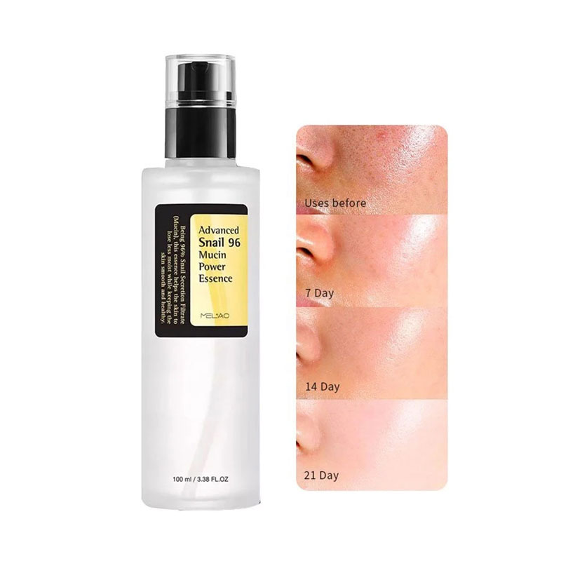 سرم اسنس حلزون